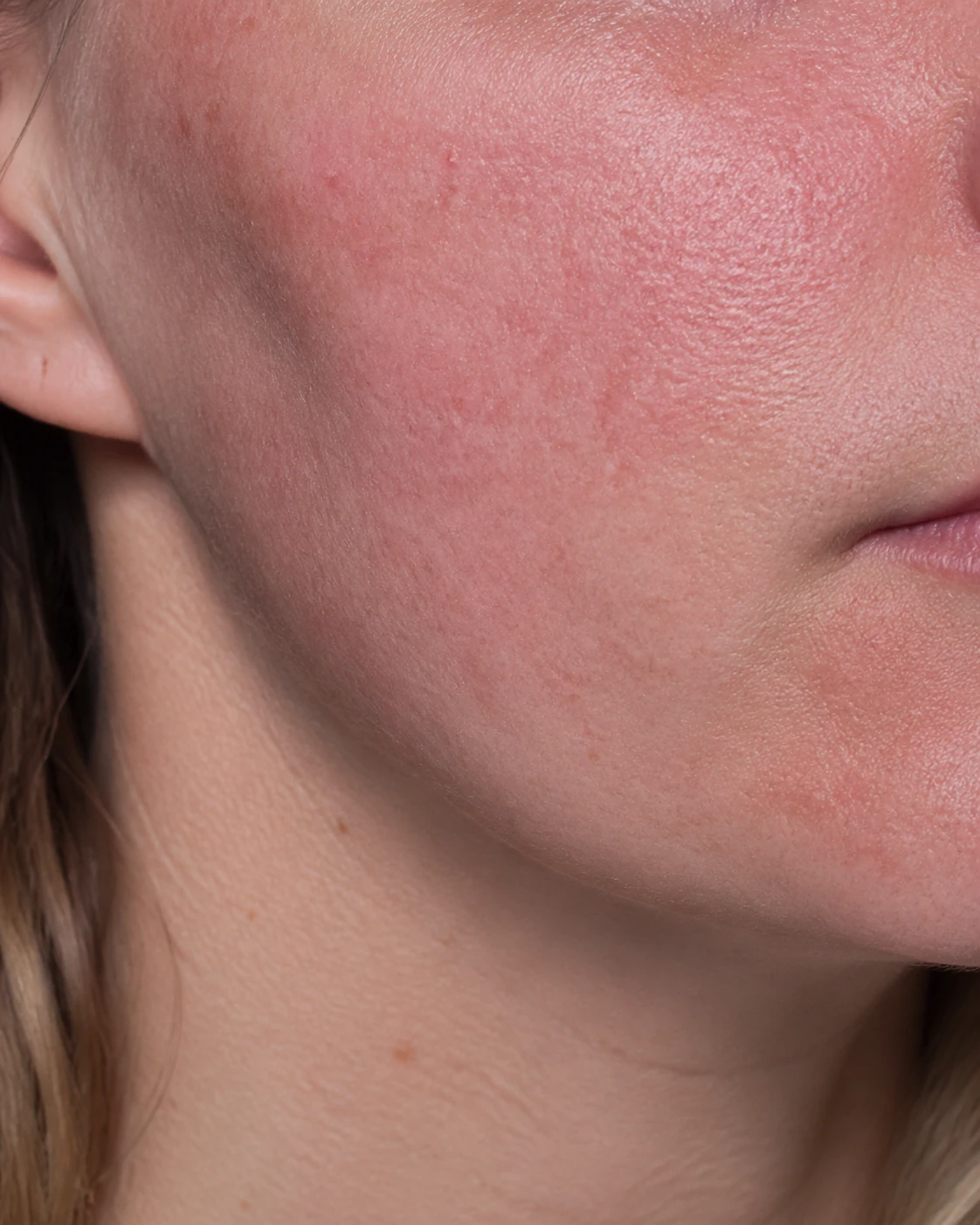 Lava Derm Kızarıklık Karşıtı Bakım Kremi için bakım görseli
